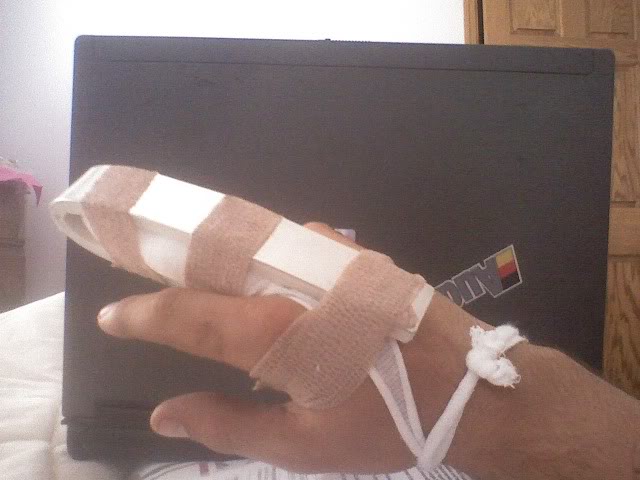 Name:  hand.jpg
Views: 642
Size:  42.7 KB