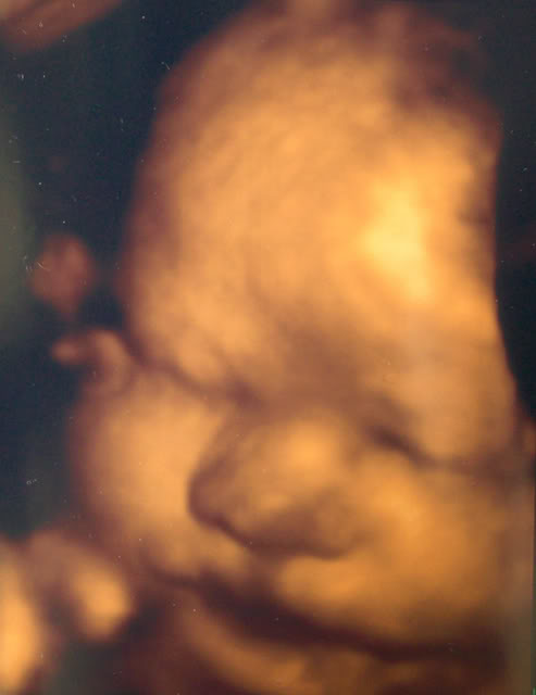 Name:  36weeks3Db.jpg
Views: 56
Size:  28.3 KB